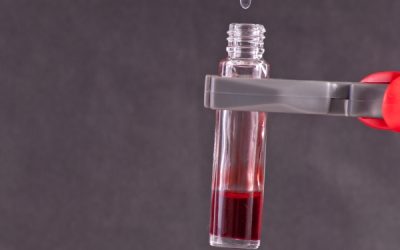 A polêmica do jejum nos procedimentos laboratoriais