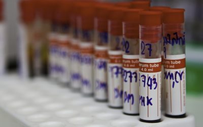 Buscar remuneração mais adequada